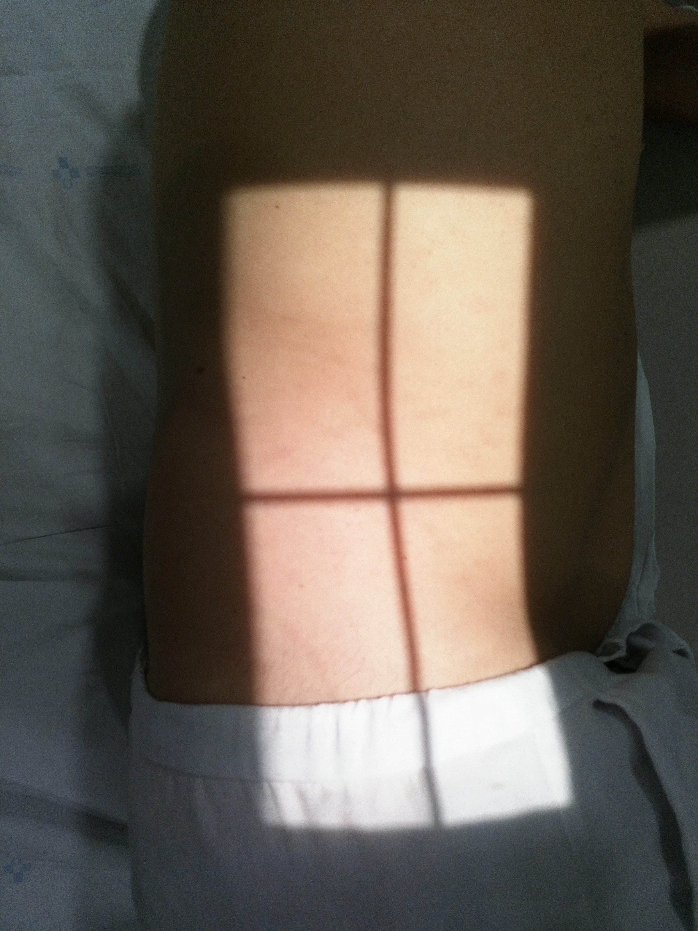 Lateral Lumbar Position Diagram